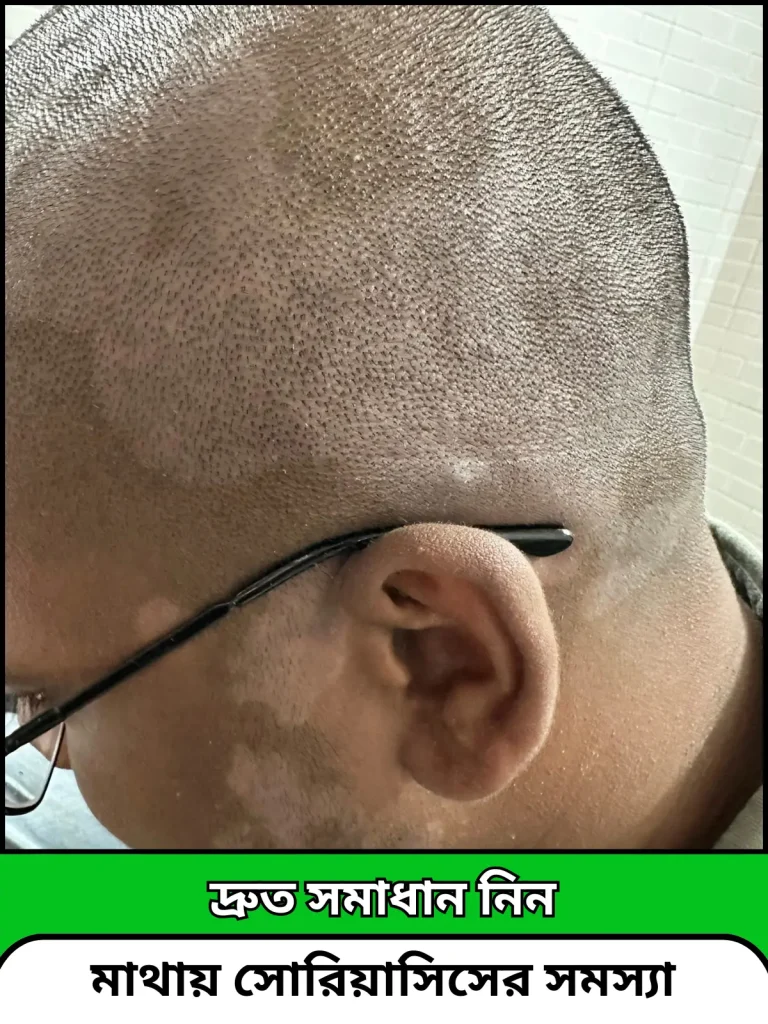 4 (3)